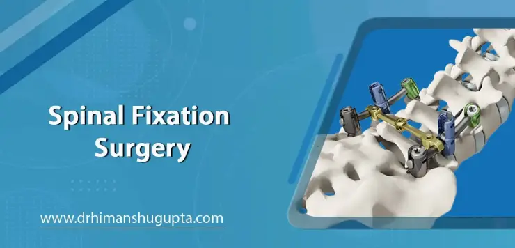 Spinal Fixation