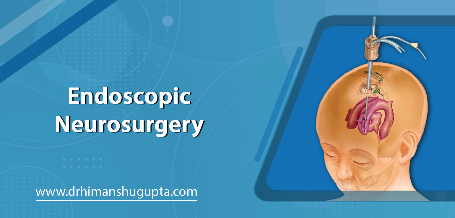 Endoscopic Neurosurgery