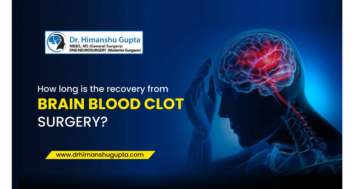 How Long Is The Recovery From Brain Blood Clot Surgery?