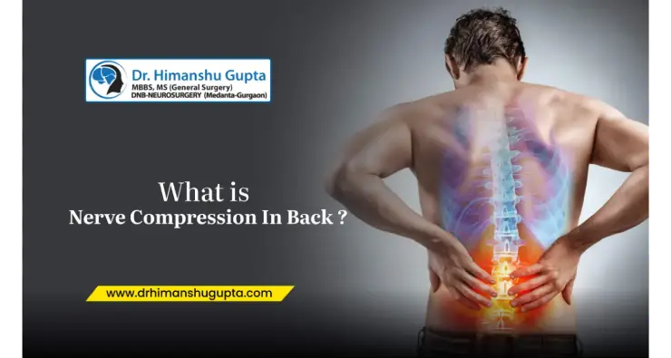 What Is Nerve Compression In Back?